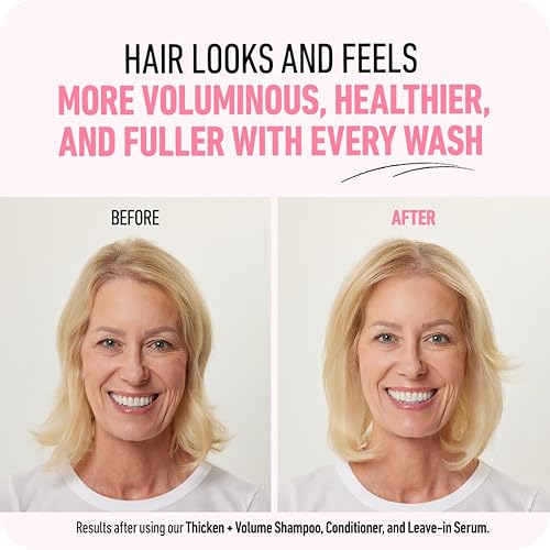 BOLDIFY THICKENING CONDITIONER WITH BIOTIN FOR HAIR VOLUME, REPAIR NOURISHMENT MEN WOMEN