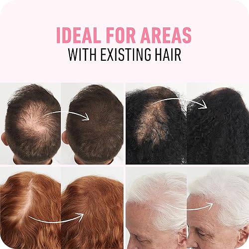 BOLDIFY HAIR FIBERS 12G - THICKEN THINNING HAIR INSTANTLY, 14 SHADES, MEDIUM BROWN