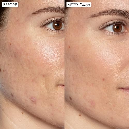 SUNDAY RILEY GOOD GENES LACTIC ACID FACE SERUM ALL-IN-ONE TREATMENT FOR RADIANT SKIN