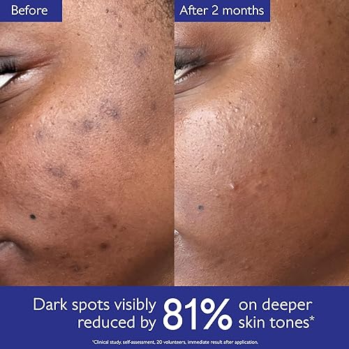 CAUDALIE VINOPERFECT BRIGHTENING SERUM WITH VINIFERINE 62X MORE EFFECTIVE THAN VITAMIN C