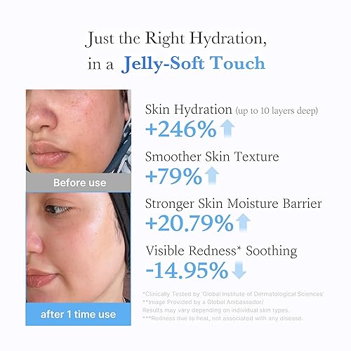 MEDICUBE JELLY CREAM WITH HYALURONIC ACID DAILY MOISTURIZER FOR ALL SKIN TYPES, 1.69 FL.OZ