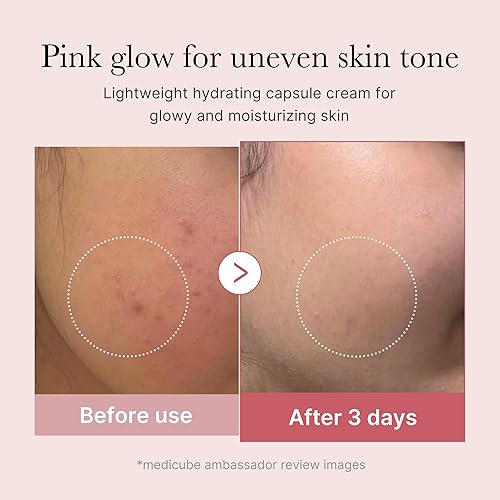 MEDICUBE CAPSULE CREAM WITH SALMON DNA PDRN NIACINAMIDE FOR GLOW, HYDRATION TEXTURE