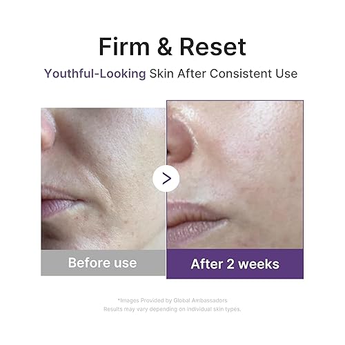 MEDICUBE RETINOL BOOSTING SERUM FIRMING, HYDRATING, PORE-REFINING KOREAN SKINCARE 1.01OZ