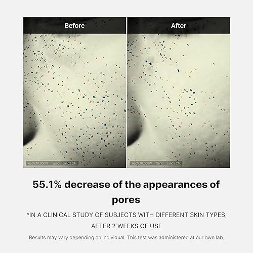 MEDICUBE ZERO PORE ONE-DAY CREAM 1.69OZ PORE REFINING, OIL CONTROL WITH NIACINAMIDE SALICYLIC ACID