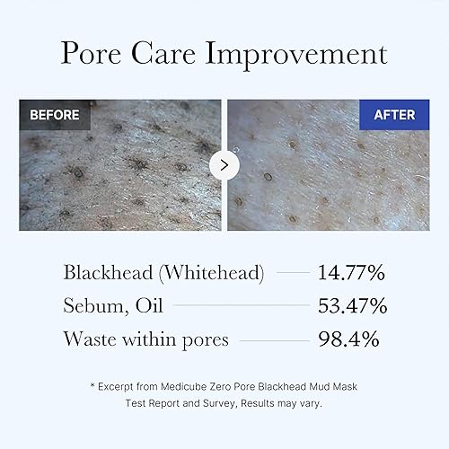 MEDICUBE ZERO PORE BLACKHEAD MUD MASK - QUICK DRY, COOLING, PORE TIGHTENING CLAY 3.52 OZ