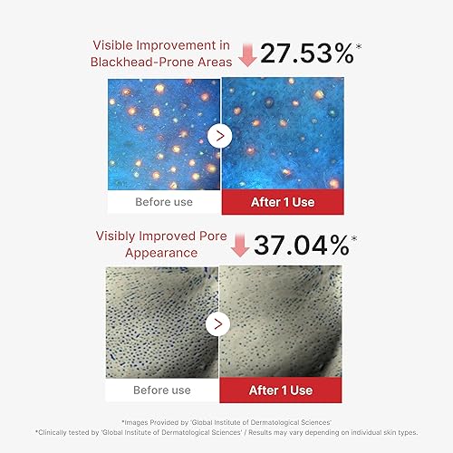 MEDICUBE HYPOCHLOROUS ACID PEEL-OFF MASK 3-PACK FOR SEBUM, PORES BLACKHEADS, HYDRATING CARE