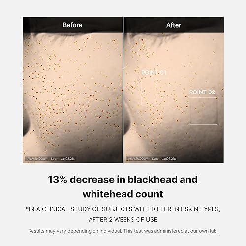 MEDICUBE ZERO PORE OVERNIGHT SERUM WITH 15.2 AHA BHA PHA 2 NIACINAMIDE FOR PORE TIGHTENING