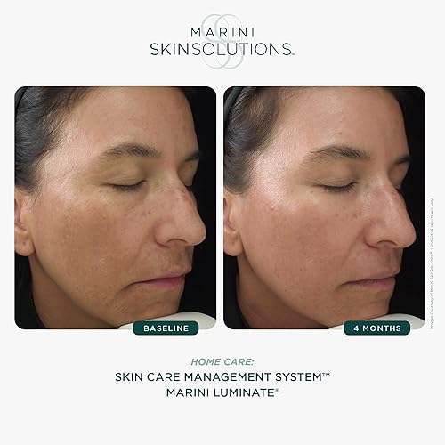 MARINI SKINSOLUTIONS LUMINATE FACE LOTION - REDUCES DISCOLORATION, FINE LINES WRINKLES