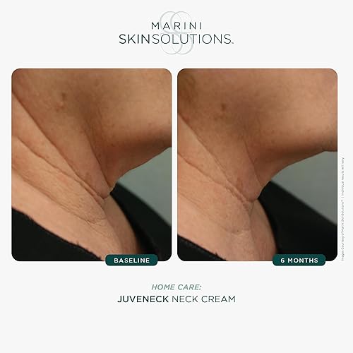 MARINI SKINSOLUTIONS JUVENECK NECK CREAM WITH PEPTIDES, DMAE HYALURONIC ACID 1.7 OZ USA MADE