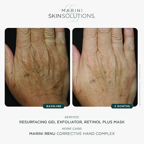 MARINI SKINSOLUTIONS RETINOL PLUS MASK WITH PEPTIDES, ANTIOXIDANTS HYALURONIC ACID - ANTI-AGING, ALL