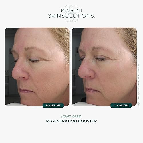 MARINI SKINSOLUTIONS REGENERATION BOOSTER FACE LOTION ANTI-AGING PEPTIDES ANTIOXIDANTS 1OZ