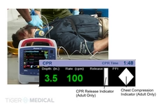 TIGERMEDICAL PROPAQ MD MONITOR/DEFIBRILLATOR
