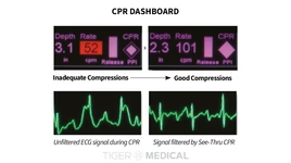 TIGERMEDICAL R SERIES ALS HOSPITAL AED DEFIBRILLATOR