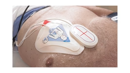 TIGERMEDICAL R SERIES ALS HOSPITAL AED DEFIBRILLATOR