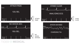 TIGERMEDICAL R SERIES BLS HOSPITAL AED/DEFIBRILLATOR