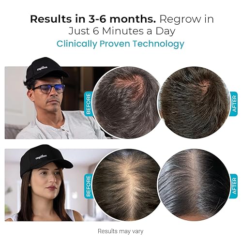 CAPILLUS SPECTRUM 312 LASER HAIR GROWTH CAP - RED LIGHT THERAPY, LLLT, BLUETOOTH, FDA CLEARED
