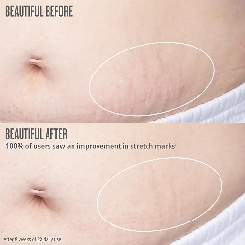 SOL DE JANEIRO BUM BUM FIRMEZA BODY OIL FOR STRETCH MARKS FIRMING HYDRATING OIL