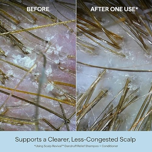 BRIOGEO SCALP REVIVAL CONDITIONER FOR DANDRUFF RELIEF, ITCH IRRITATION TREATMENT