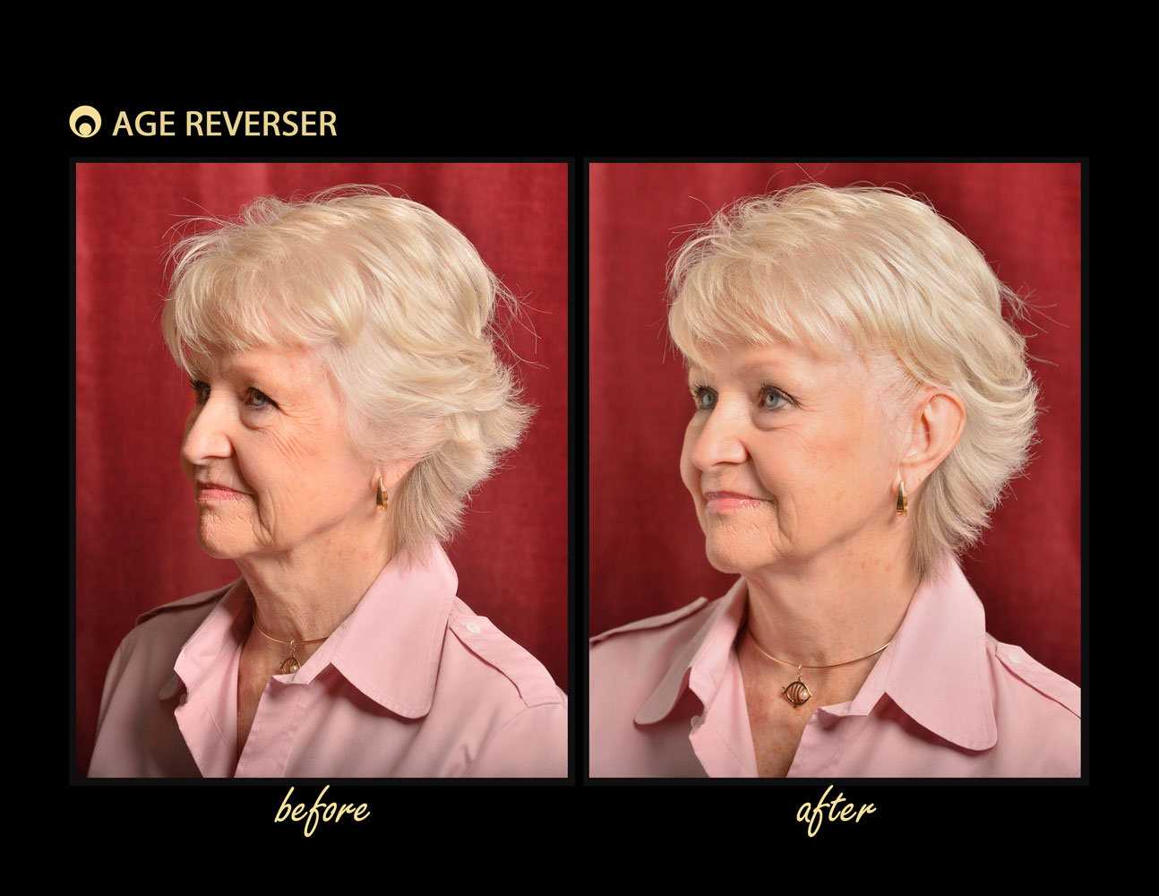 Age Reverser The Facelift Band-1