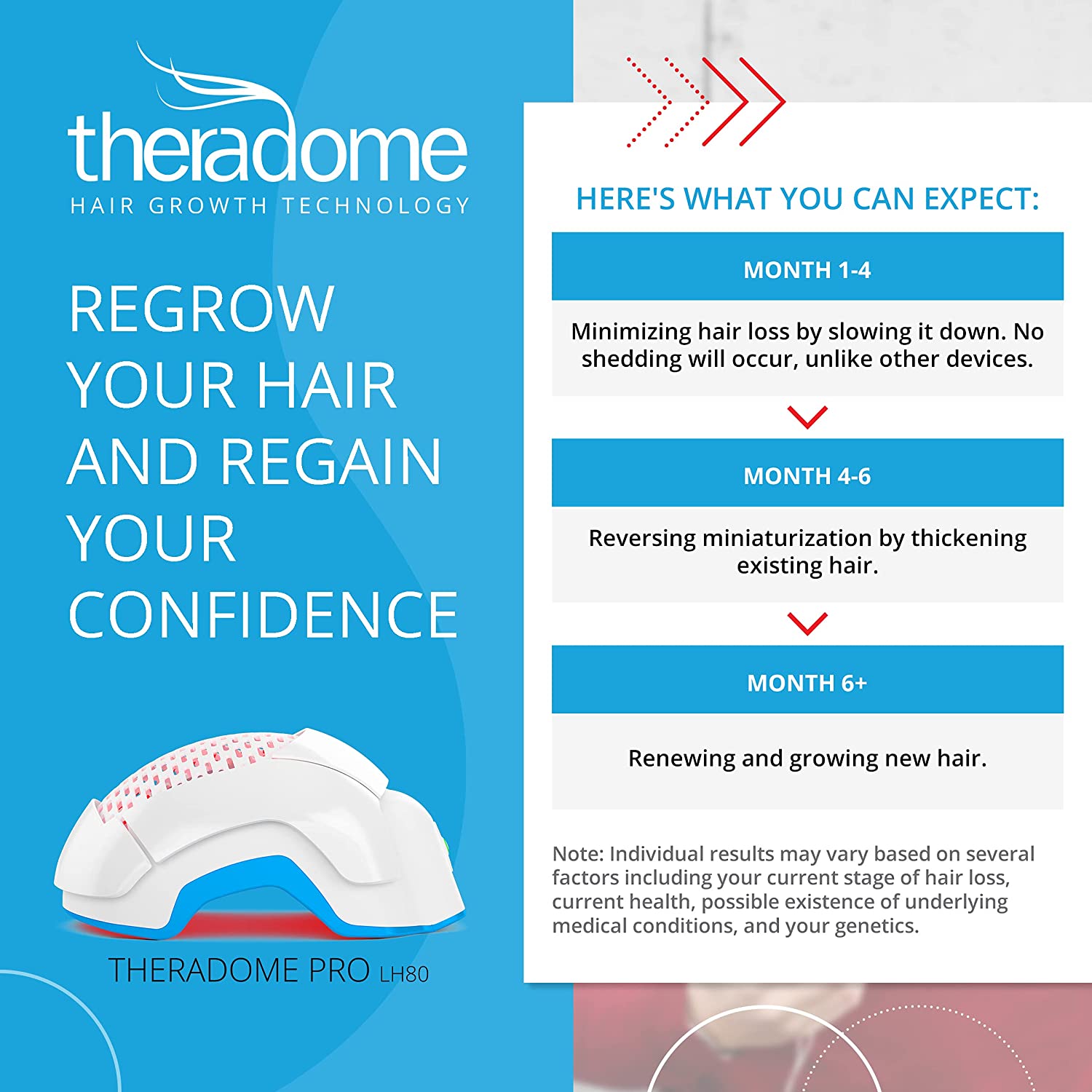 Theradome Pro Laser Hair Growth Helmet LH80-2