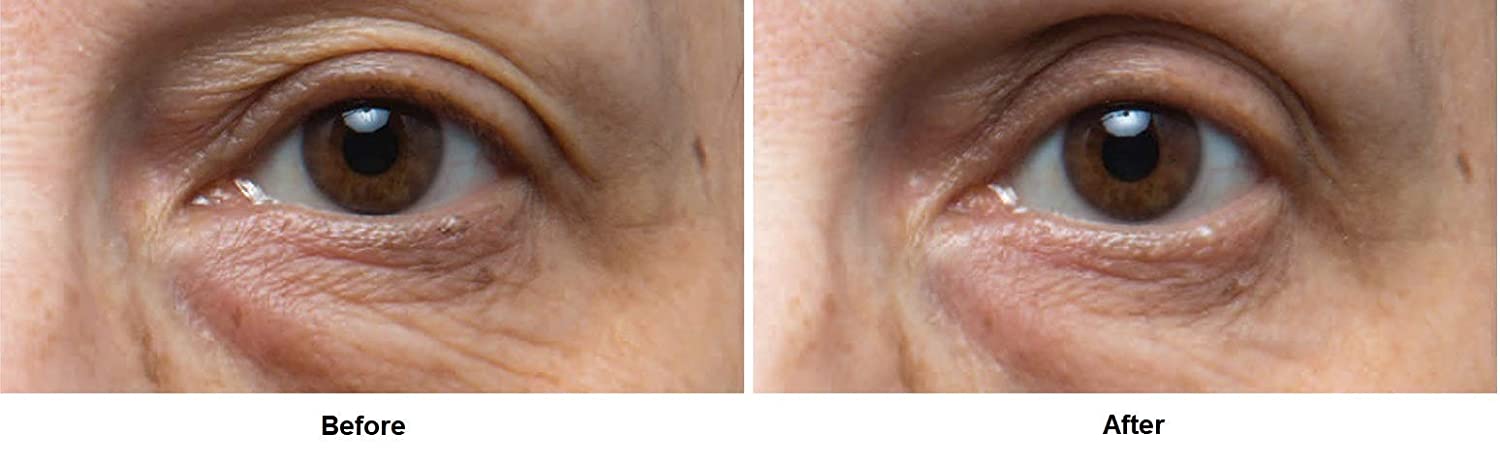 Dr. Dennis Gross Ferulic + Retinol Eye Cream - 0.5 Oz-4