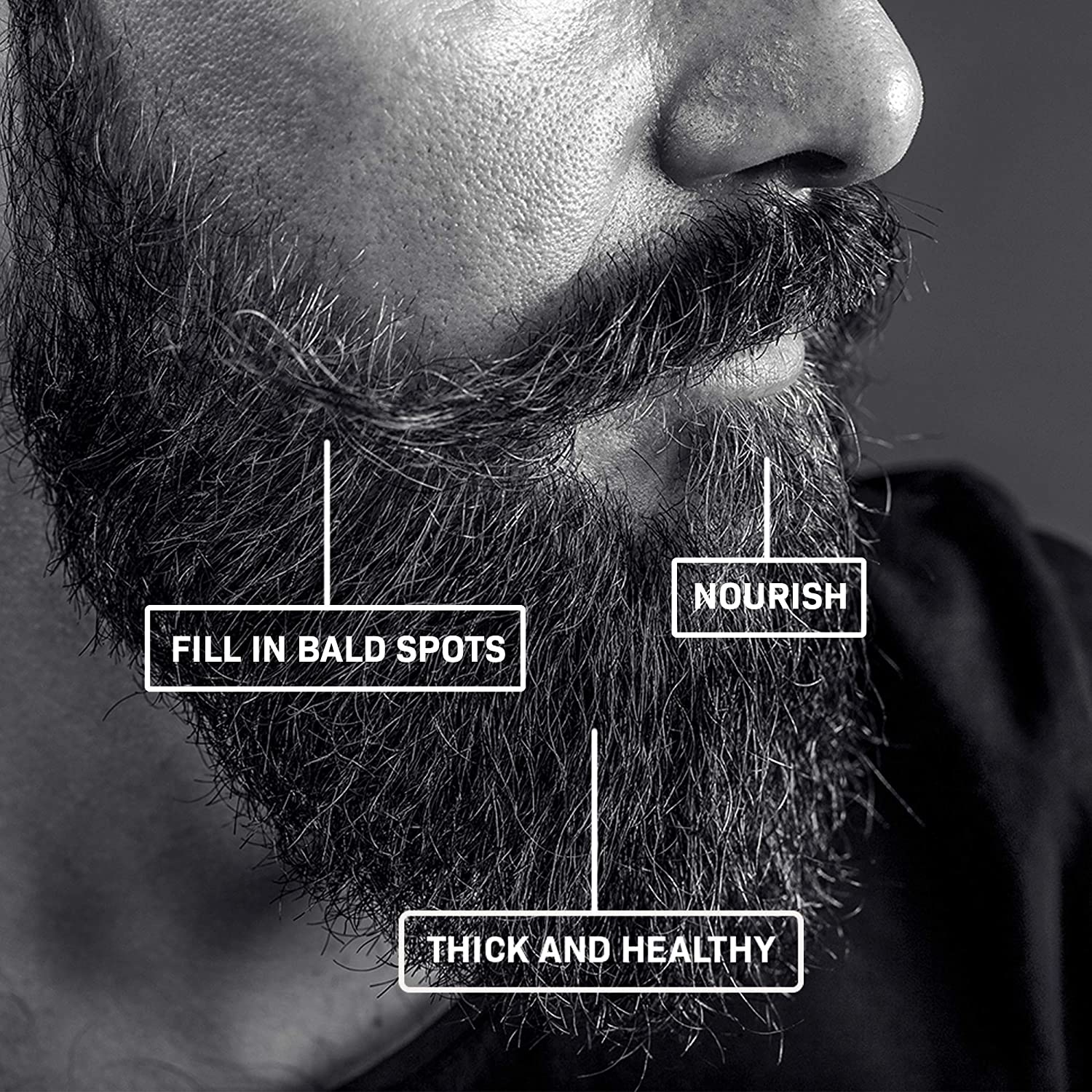 Beard Growth Kit - Derma Roller for Beard Growth and Beard Growth Serum-2