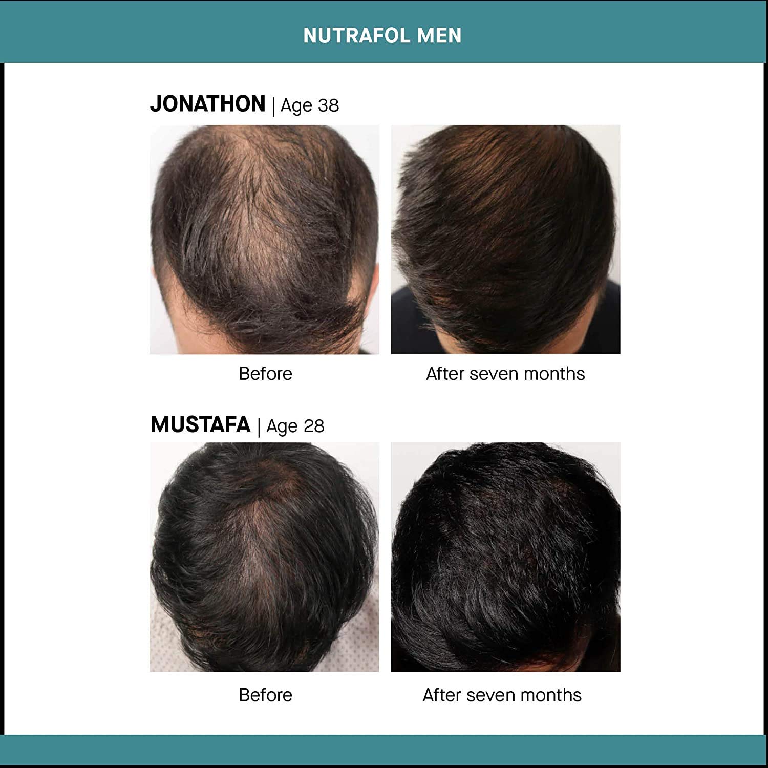 Nutrafol Mens Hair Growth Supplement - 3 Aylık Kür-1