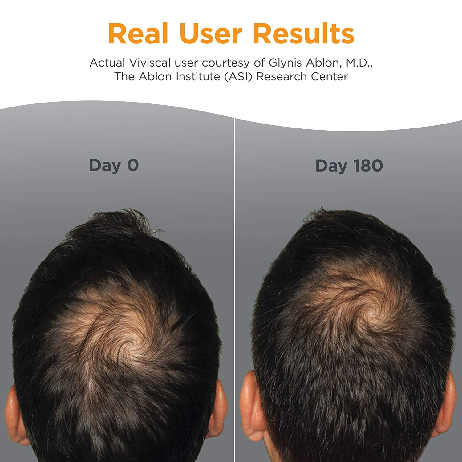 Viviscal Man Hair Growth Supplements - 60 Tablet-1